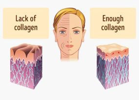 Collagen là gì? Làm thế nào để bổ sung Collagen cho cơ thể